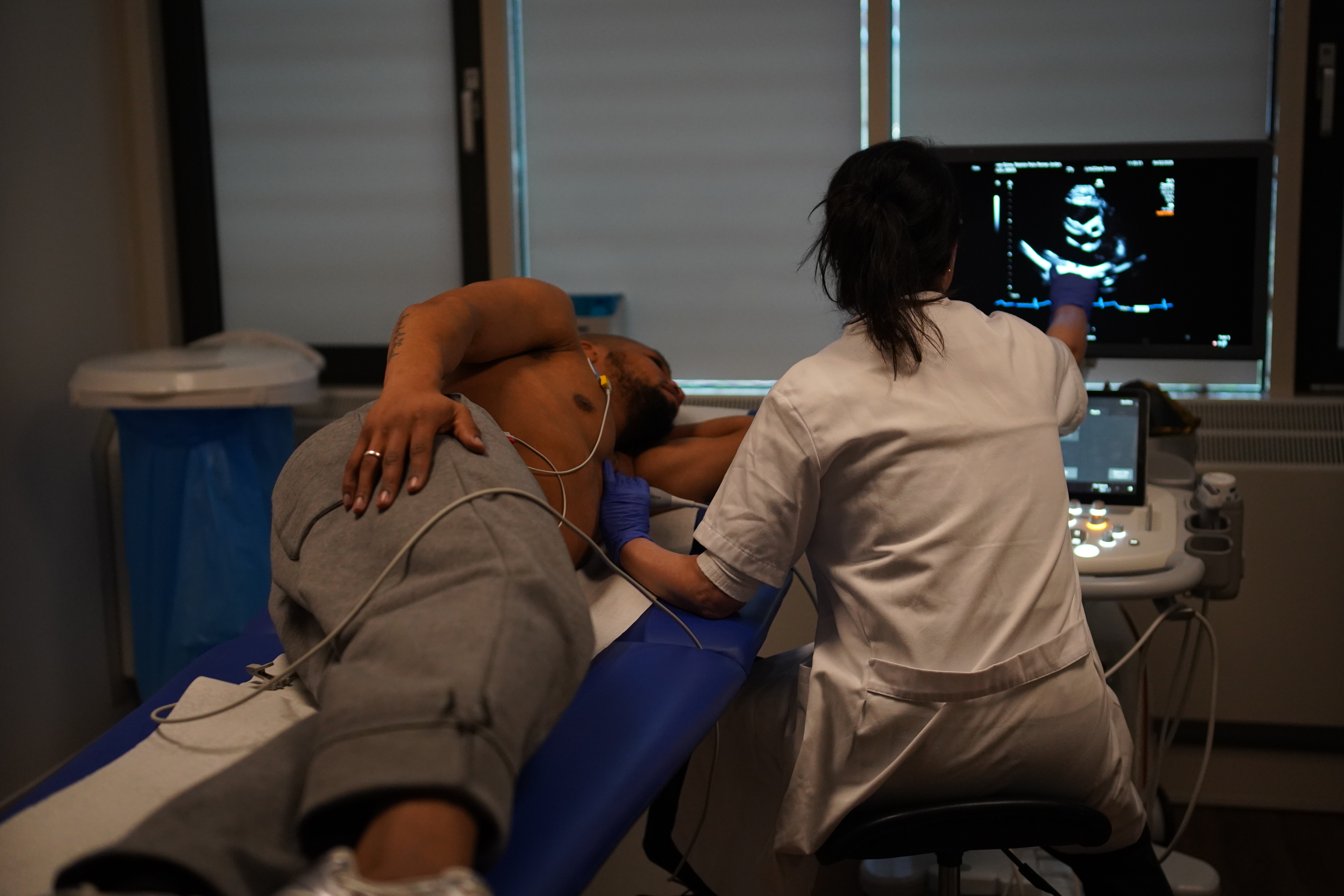 UCP echocardiography